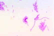Pseudomonas fluorescens with acid Fuchsin stained bright field
