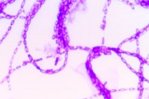 Bacillus subtilis with crystal violet stained bright field