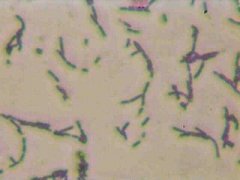 S6 - a second picture of sulfur oxidizing gram-positive bacterial strain from Alken-Murray's collection